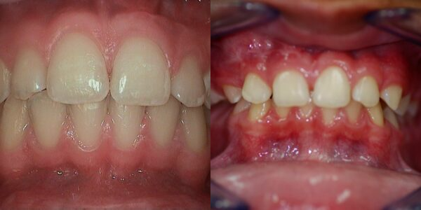 Images Haws Family Dentistry