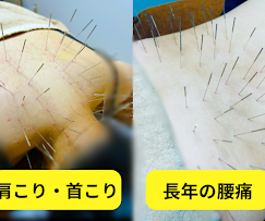 Images 鍼処KAKUREGA
