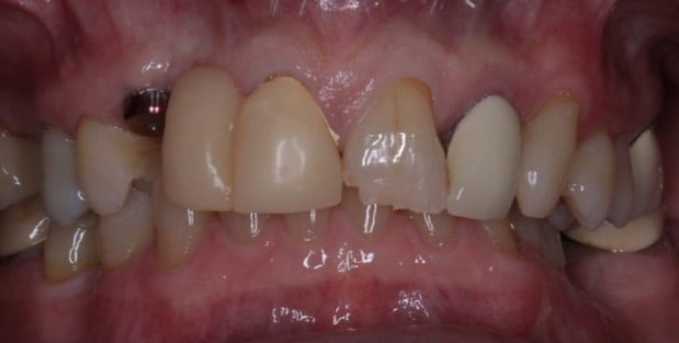 Images Enrich Dental