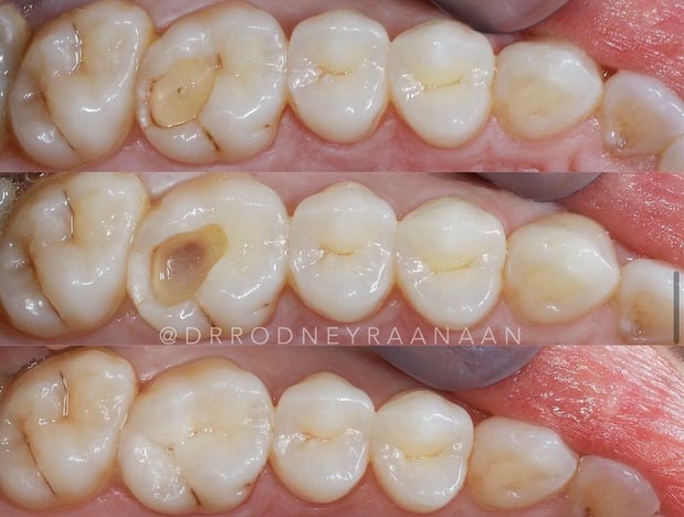 Images Dr. Rodney Raanan