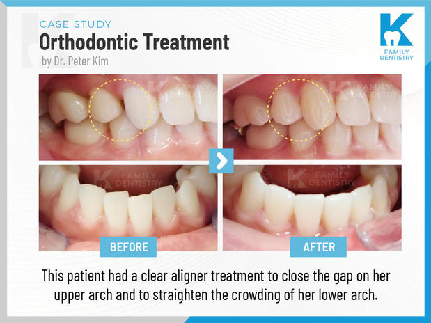Images K Family Dentistry General Cosmetic Emergency Implants