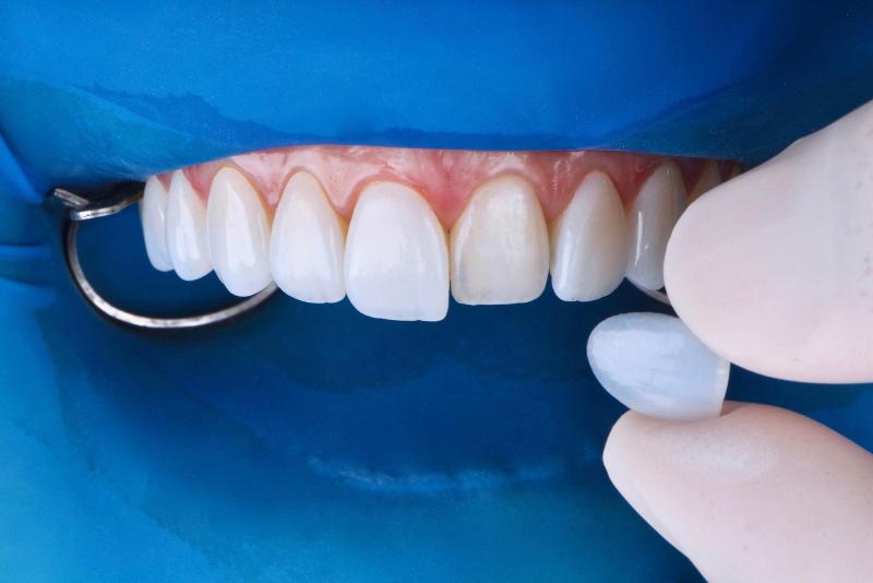 Images Centro Odontoiatrico Aufiero Dr. Giovanni