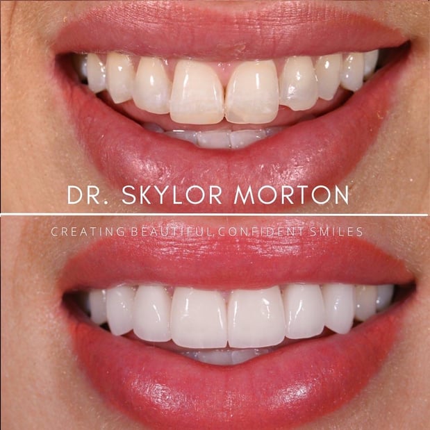 Images Nashville Wisdom Teeth and Implant Solutions