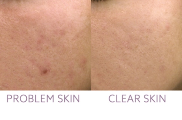 Images Renew Body Contouring & MedSpa