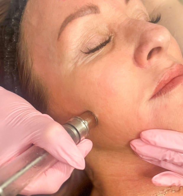 Images Che Bella Injectables And Aesthetics