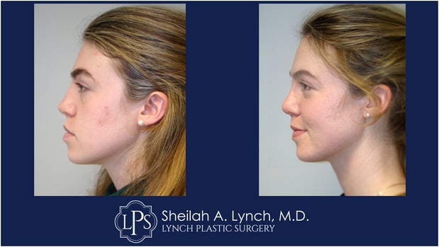 Images Sheilah A. Lynch, MD - Lynch Plastic Surgery