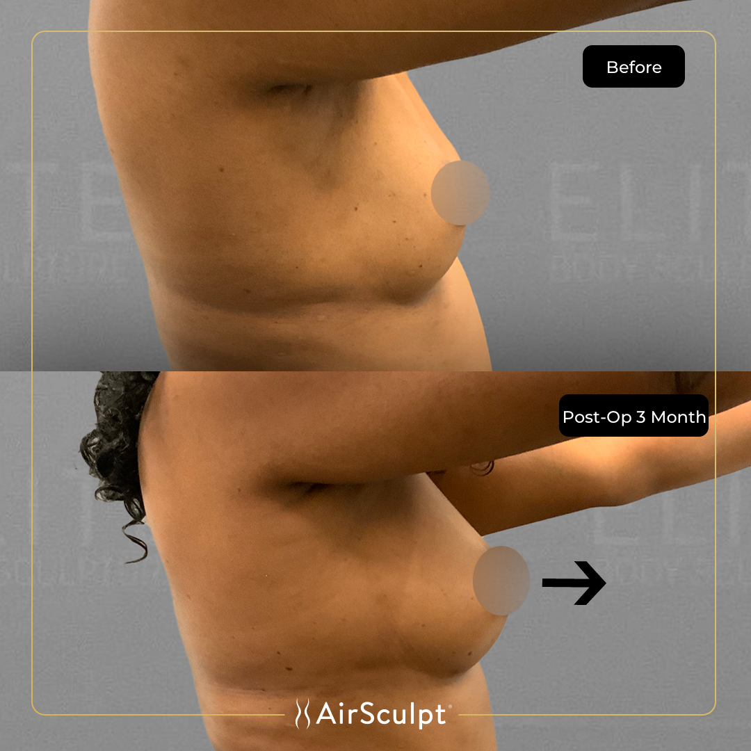 Images Elite Body Sculpture