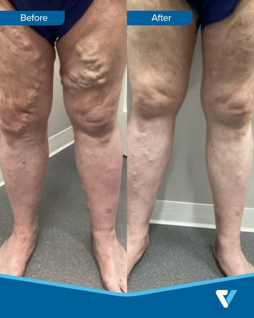 Images Physicians Vein Clinics