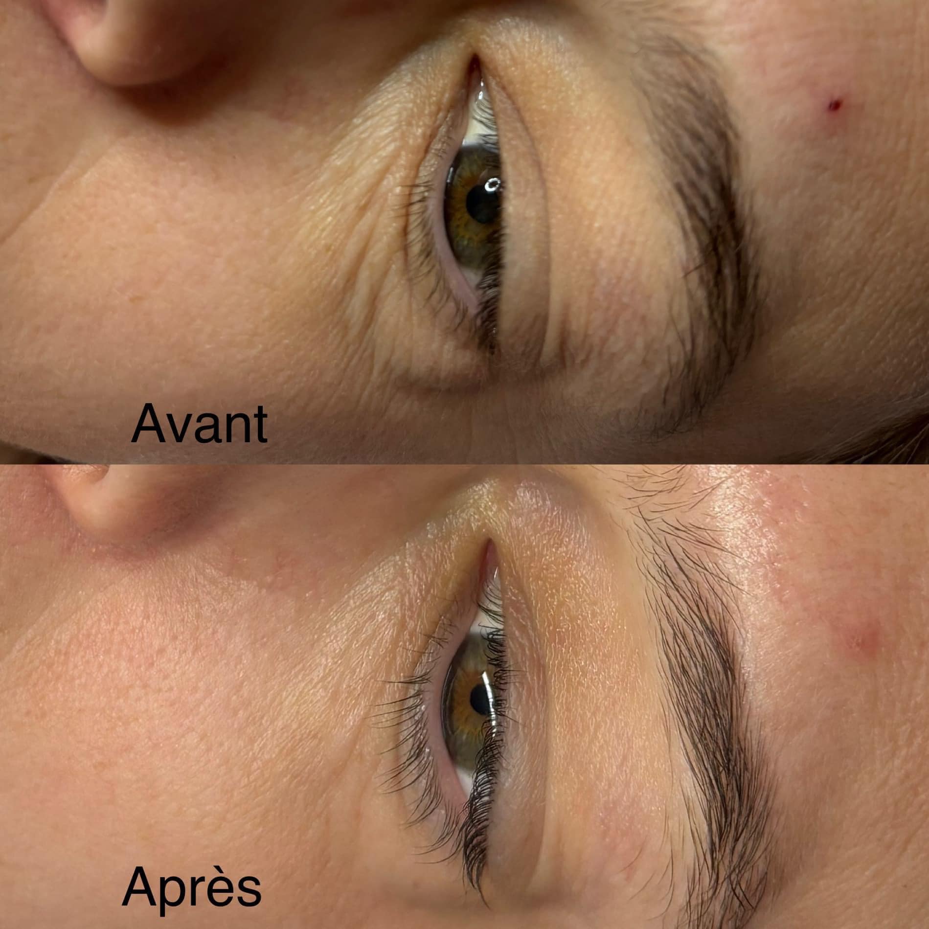 Images MKN Esthétique Laser & Bien-être
