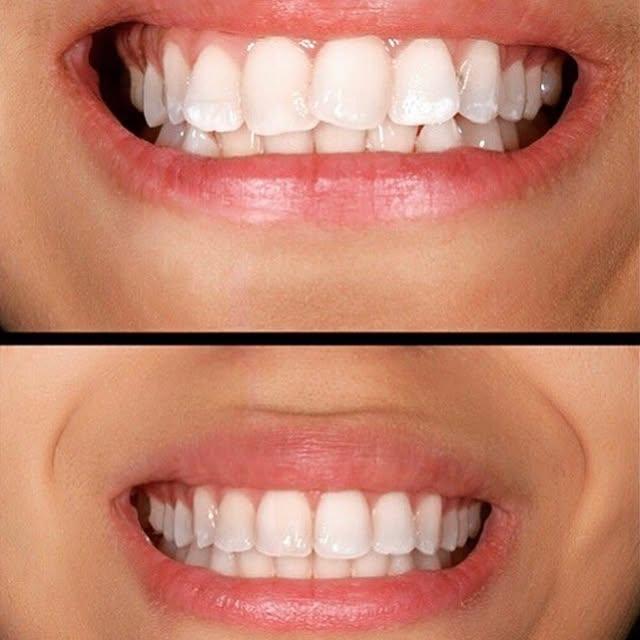 Images Smiles By Eddie: Dr. Edmond Ahdoot DDS