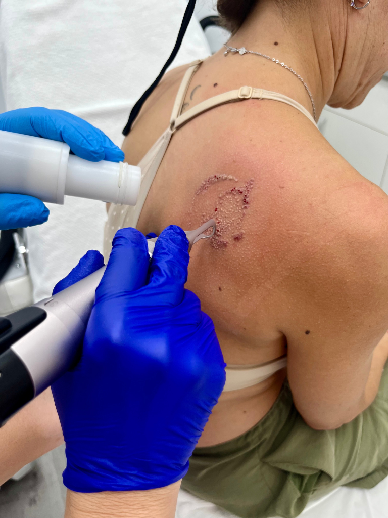 Images Dra. Silvia Solà. Medicina Estética y Láser