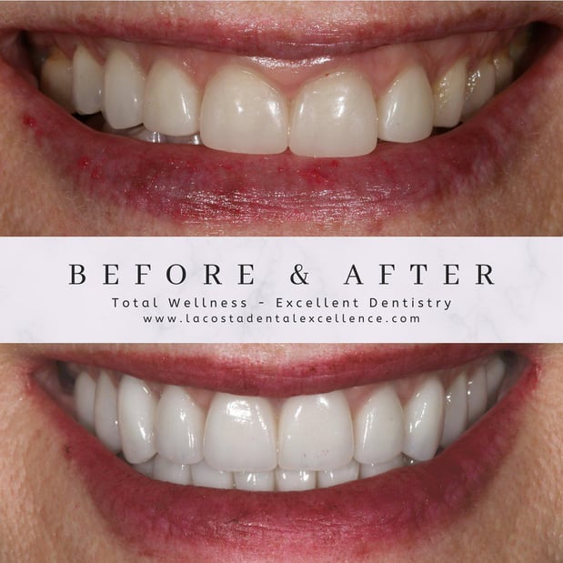 Images Oceanside Dental Excellence