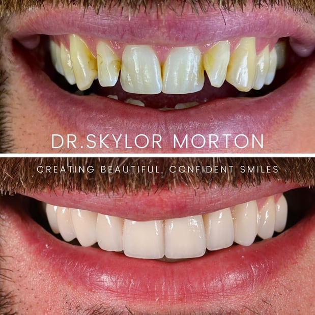 Images Nashville Wisdom Teeth and Implant Solutions