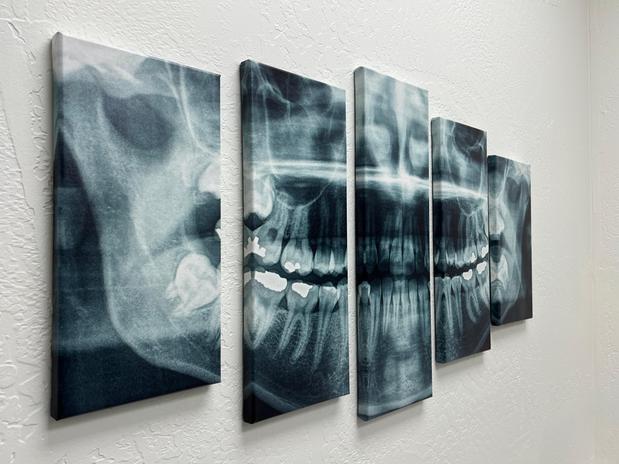 Images Mesa Dental Implants & Dentures