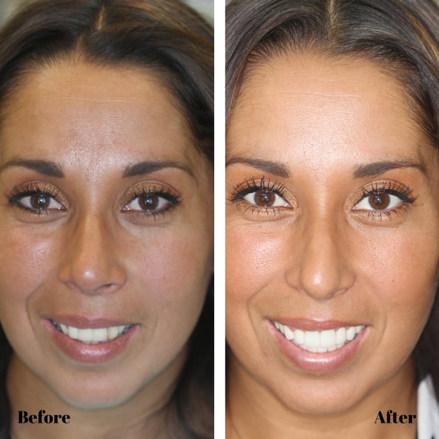 Images Almeida & Bell Dental Lone Tree - General, Cosmetic, and Implant Dentistry