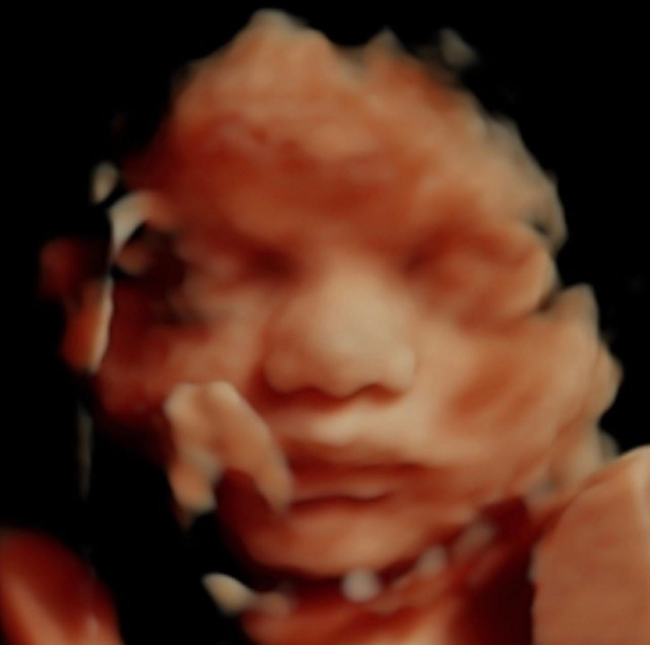 Image 7 | Belly 2 Birth 3D 4D Ultrasound