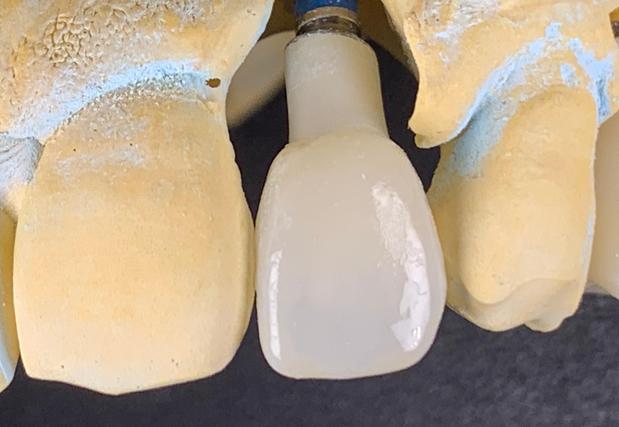 Images South Shreveport Dental