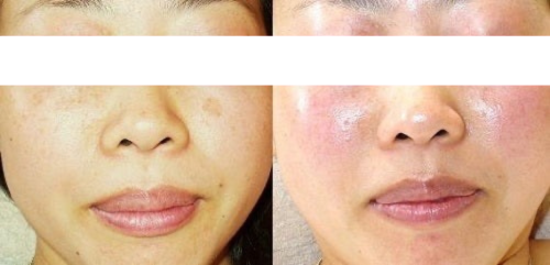 Images 素肌美専門サロンMuni.福井【ムニ】