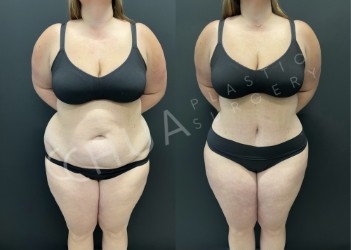 Images Chua Plastic Surgery