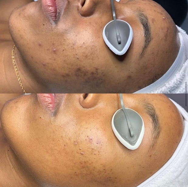 Images Face of Jules