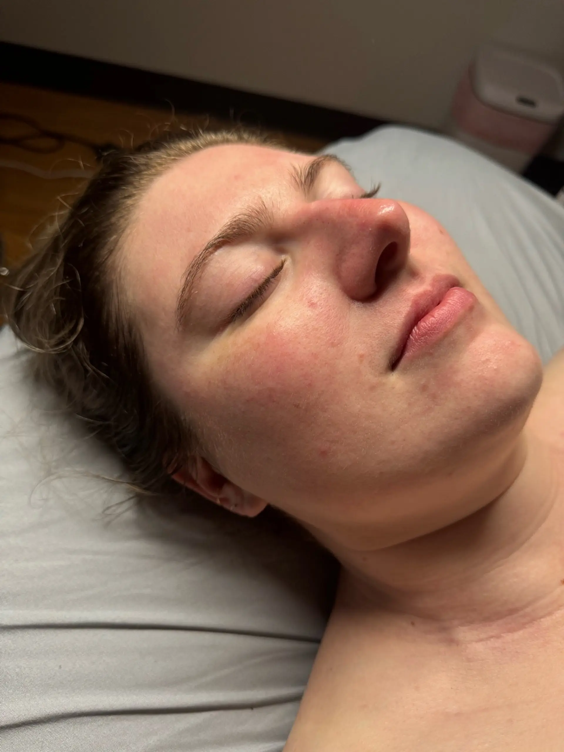 Close-up of a woman's face with her eyes closed, lying down. Her skin appears flushed and has some minor blemishes. A pink and white appliance is visible in the background.