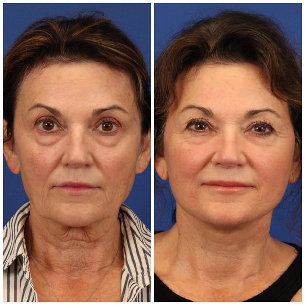 Images Dr. Sumit Bapna, MD