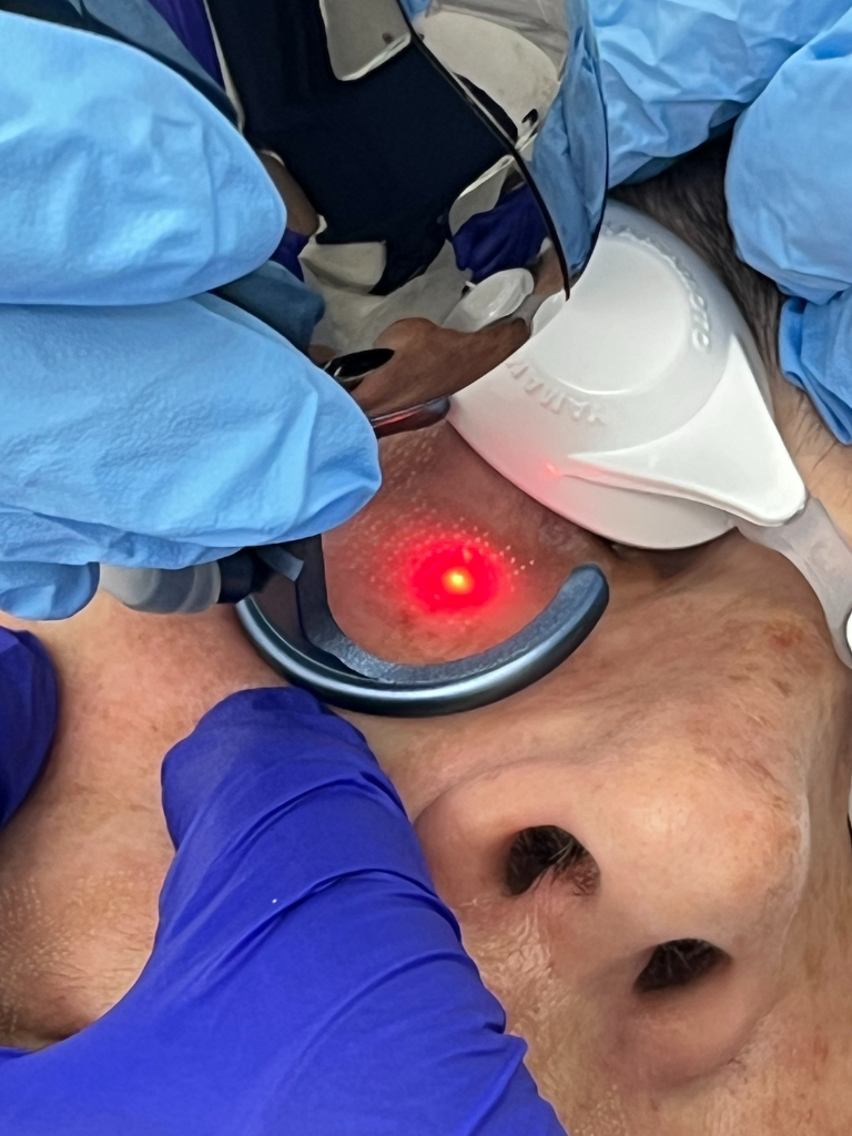 Images Dra. Silvia Solà. Medicina Estética y Láser