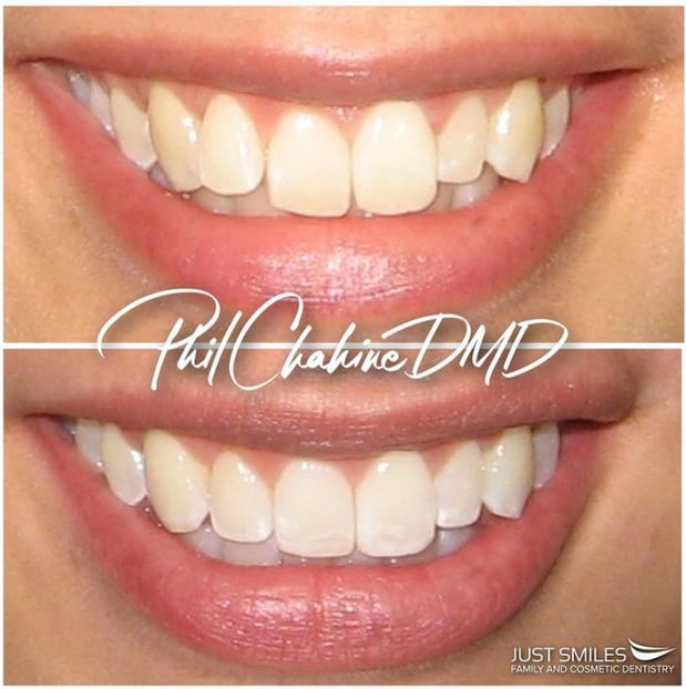Images Just Smiles - General, Cosmetic & Implant Dentistry