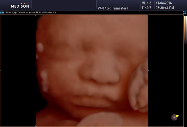 Images Heavenly 3D 4D Ultrasounds