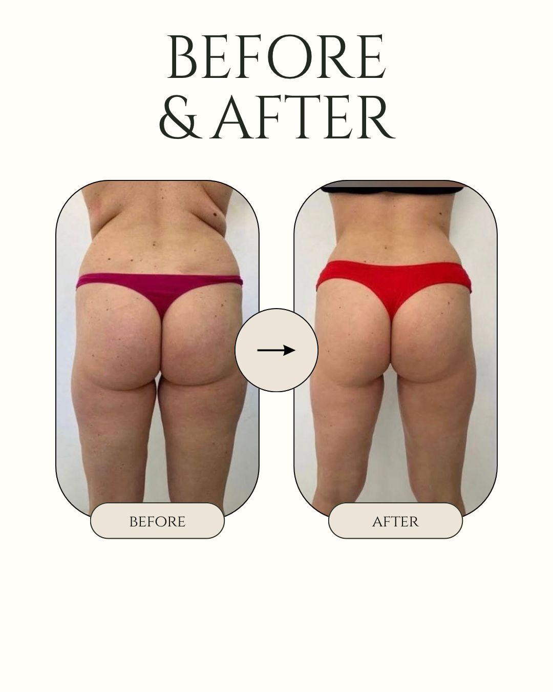 Images HOLLYWOOD BODY&FACE