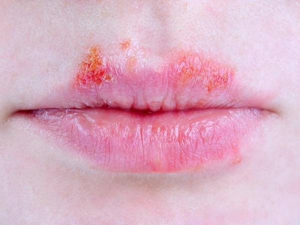 Images Coronese Dr. Antonio