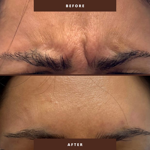 Images Sunkissed Med Spa