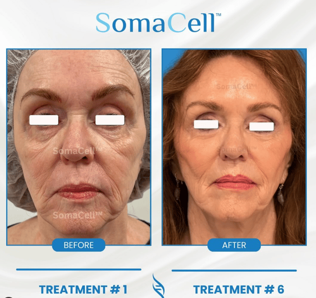 Images IT Intelligent Treatment