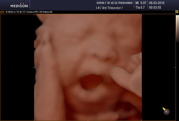 Images Heavenly 3D 4D Ultrasounds