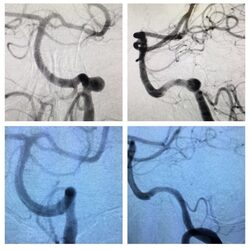 Yashar Neurosurgery Photo