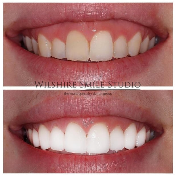 Images Wilshire Smile Studio - Los Angeles Dentist, Cosmetic and Emergency Dentistry