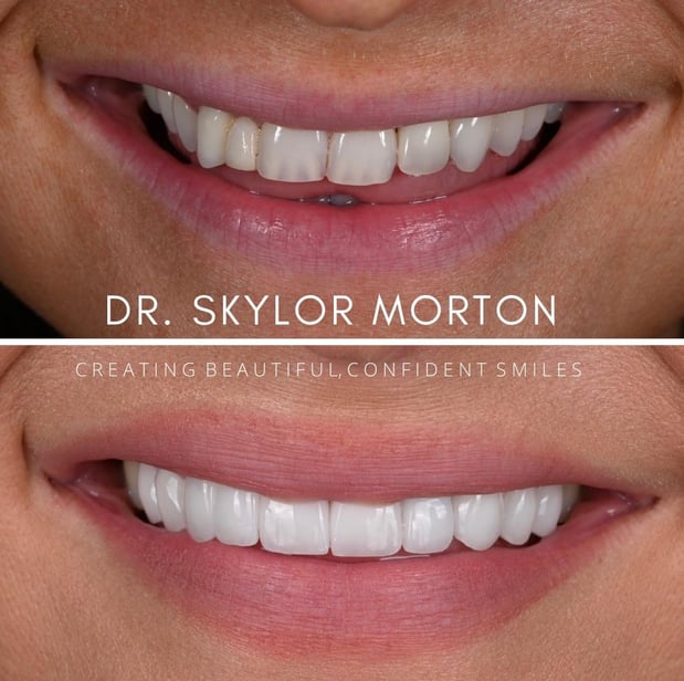 Images Nashville Wisdom Teeth and Implant Solutions