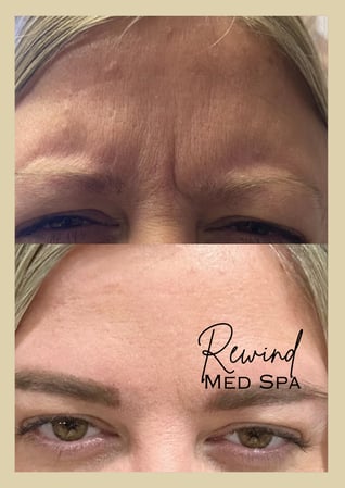 Images Rewind Med Spa