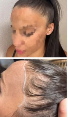 Images Giorgia Hair Clinic
