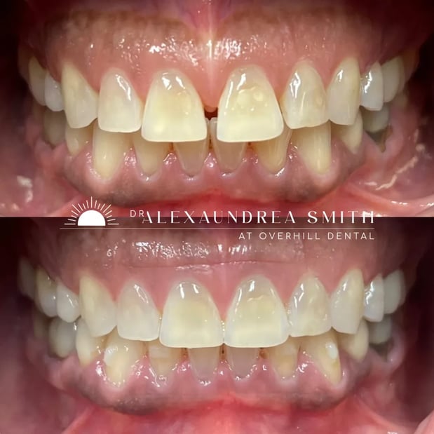 Images Overhill Dental