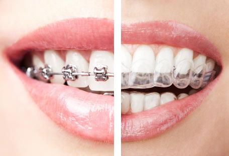Images Best Dental - Family & Orthodontics