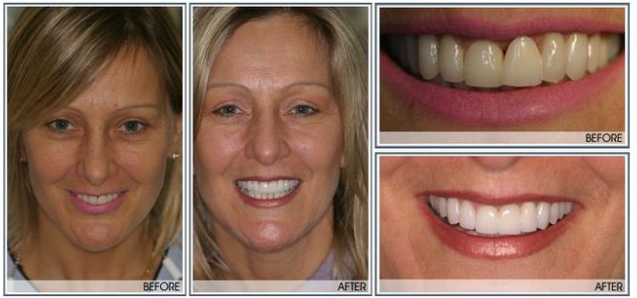 Results of Exton Dental Health Group | Exton, PA