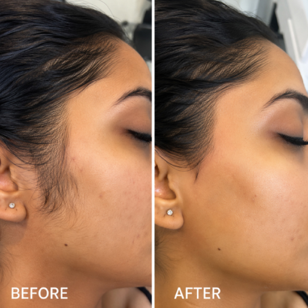 Professional full-face threading for sensitive skin at Avissa Salon in Ann Arbor. This before-and-af 