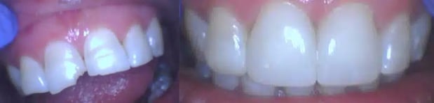 Images Twin Branch Dental