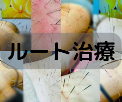 Images 鍼処KAKUREGA