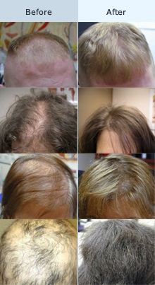 Images Unique Creations Hair Replacement * Braiding Salon & Spa