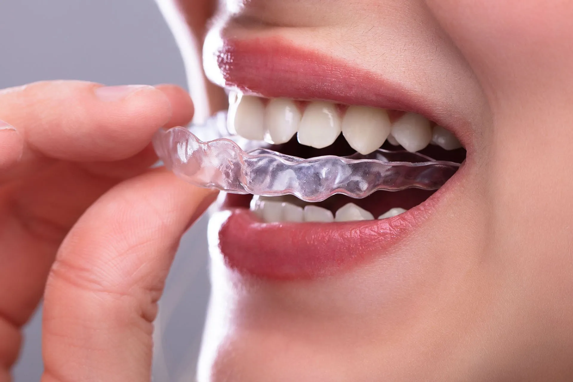 Bennett Family Dental Image