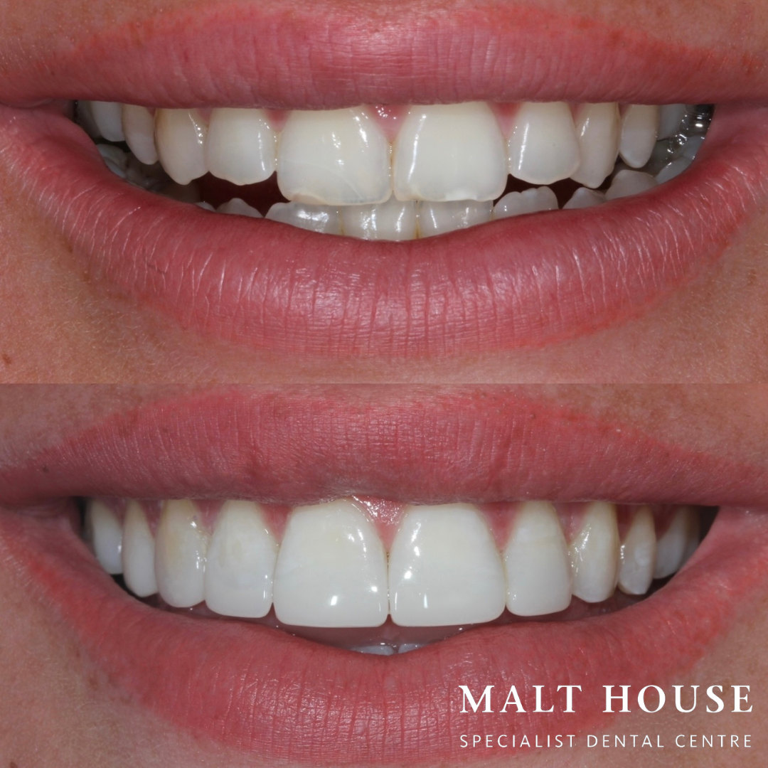 Malt House Specialist Dental Centre Malt House Specialist Dental Centre Manchester 01618 329400