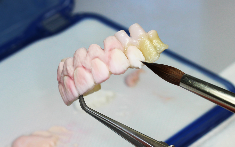 Bilder dental moeschli.ch ag