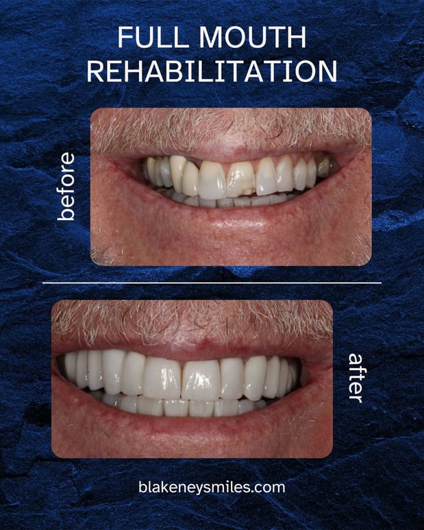 Images Advanced Dentistry of Blakeney